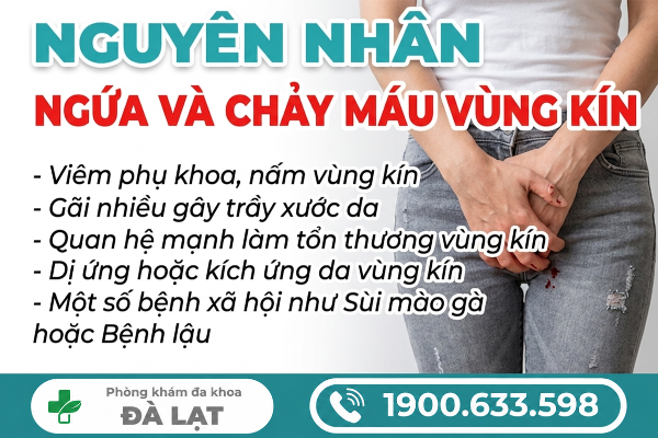 Hình ảnh minh họa